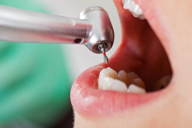 Best Emergency Root Canal Therapy in New Brunswick, NJ